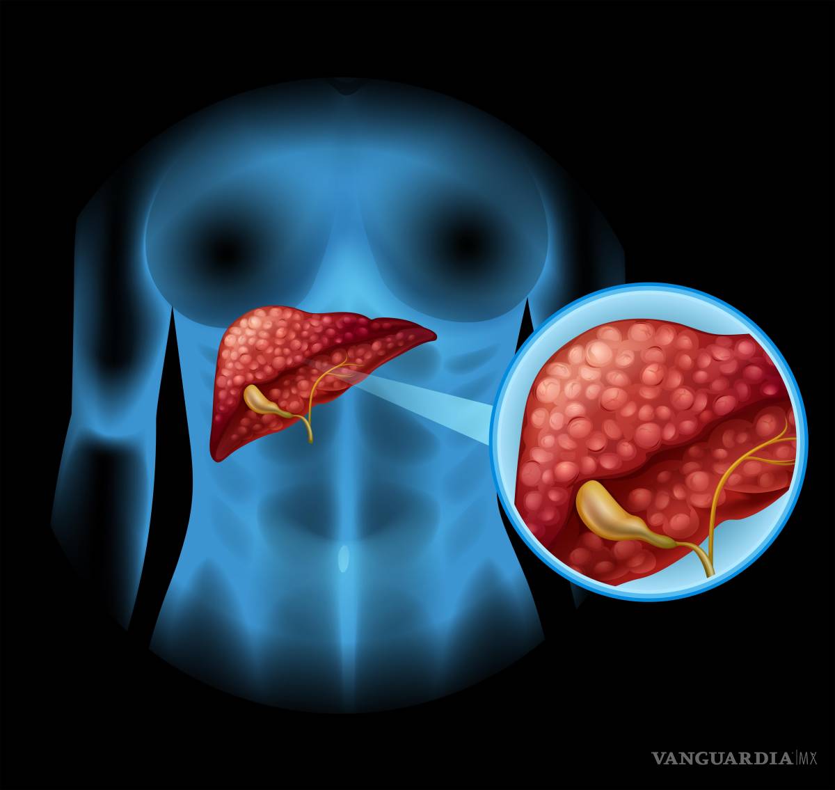 $!Nueva evidencia científica advierte que este tipo de alimentación puede reconfigurar profundamente las células del hígado.