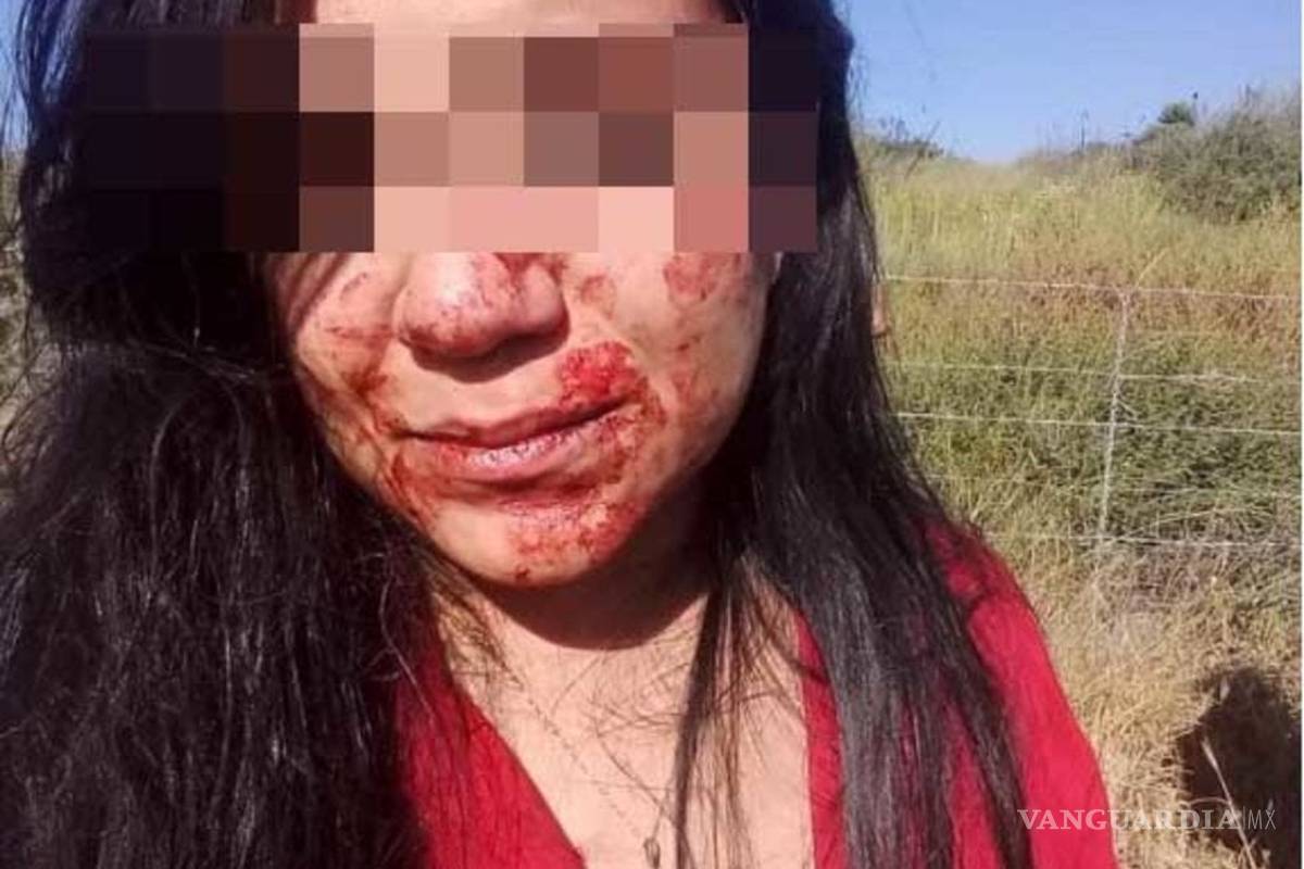 Aún sin castigo joven saltillense que dio golpiza a su novia