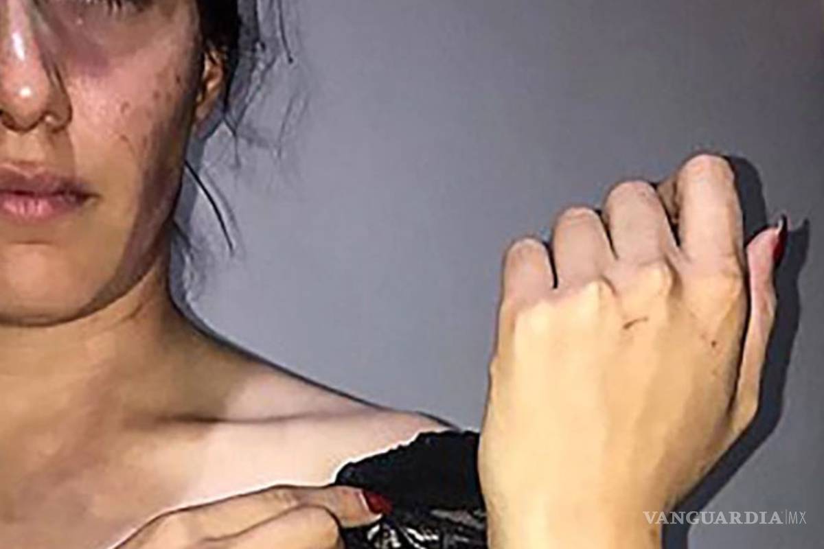 Primero golpea a su novia en un bar, luego intenta meterla en la cajuela (video)