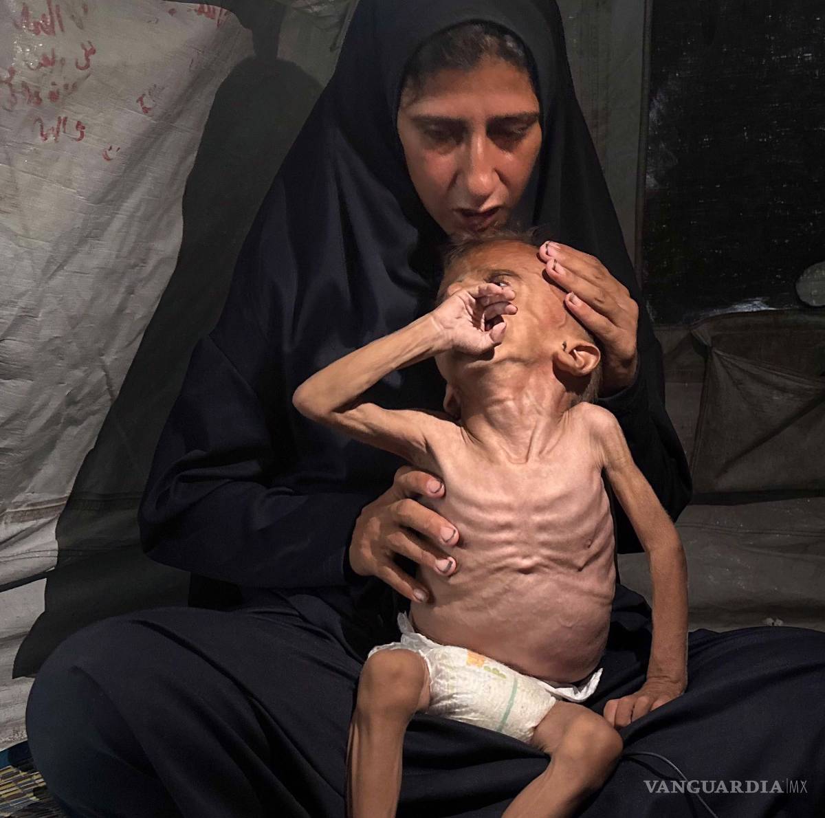 $!La crisis por desnutrición en Gaza ganó visibilidad con imágenes como las del pequeño Mohamed Motawaq.