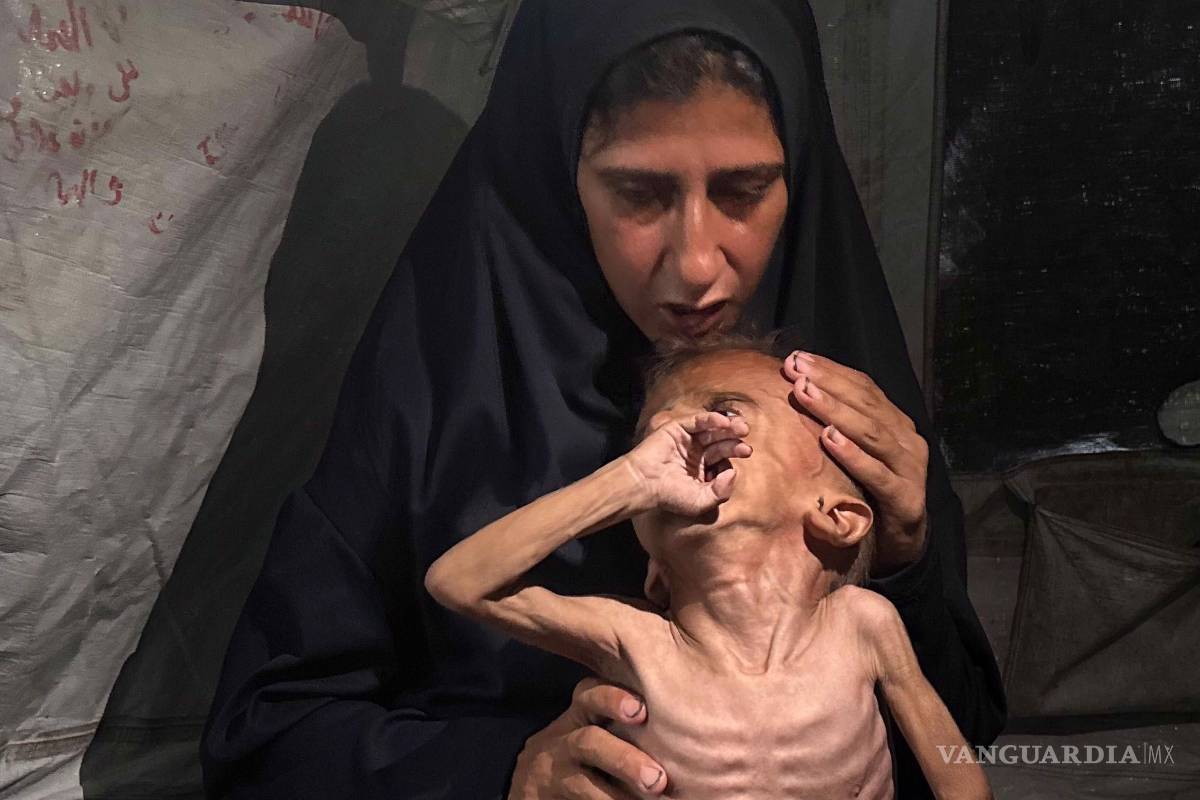 $!La crisis por desnutrición en Gaza ganó visibilidad con imágenes como las del pequeño Mohamed Motawaq.