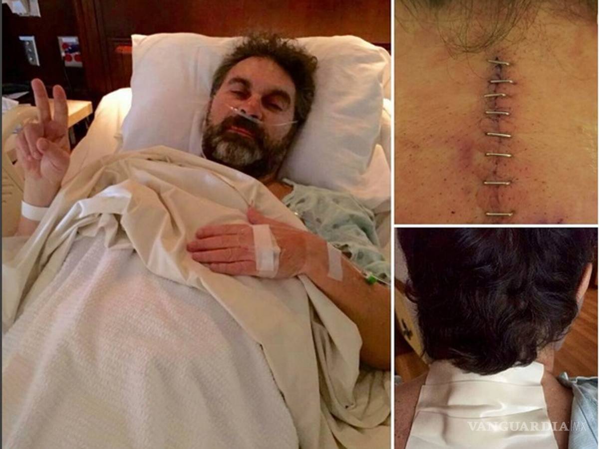 $!¡Impactantes imágenes! Mijares se somete a operación en la columna