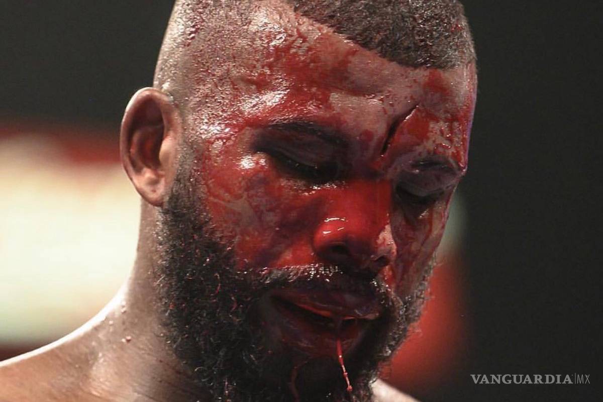 El impactante corte en la frente de un boxeador
