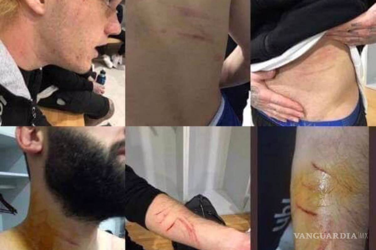 Un jugador turco agredió a sus rivales...¡con una navaja de afeitar!