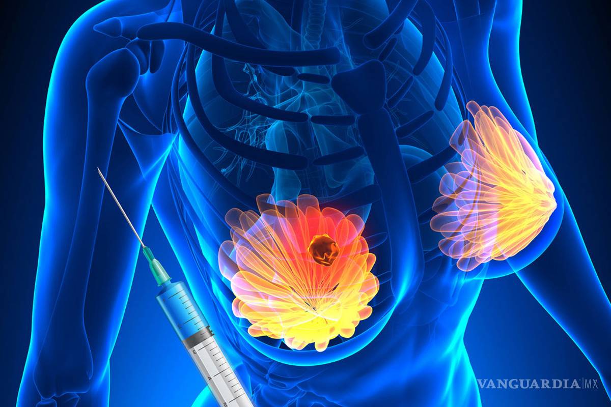 Empresa mexicana desarrolla exitoso nanodispositivo para cáncer de mama