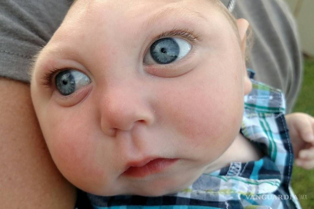 El extraño caso del bebé Jaxon 'Strong' sorprende a médicos