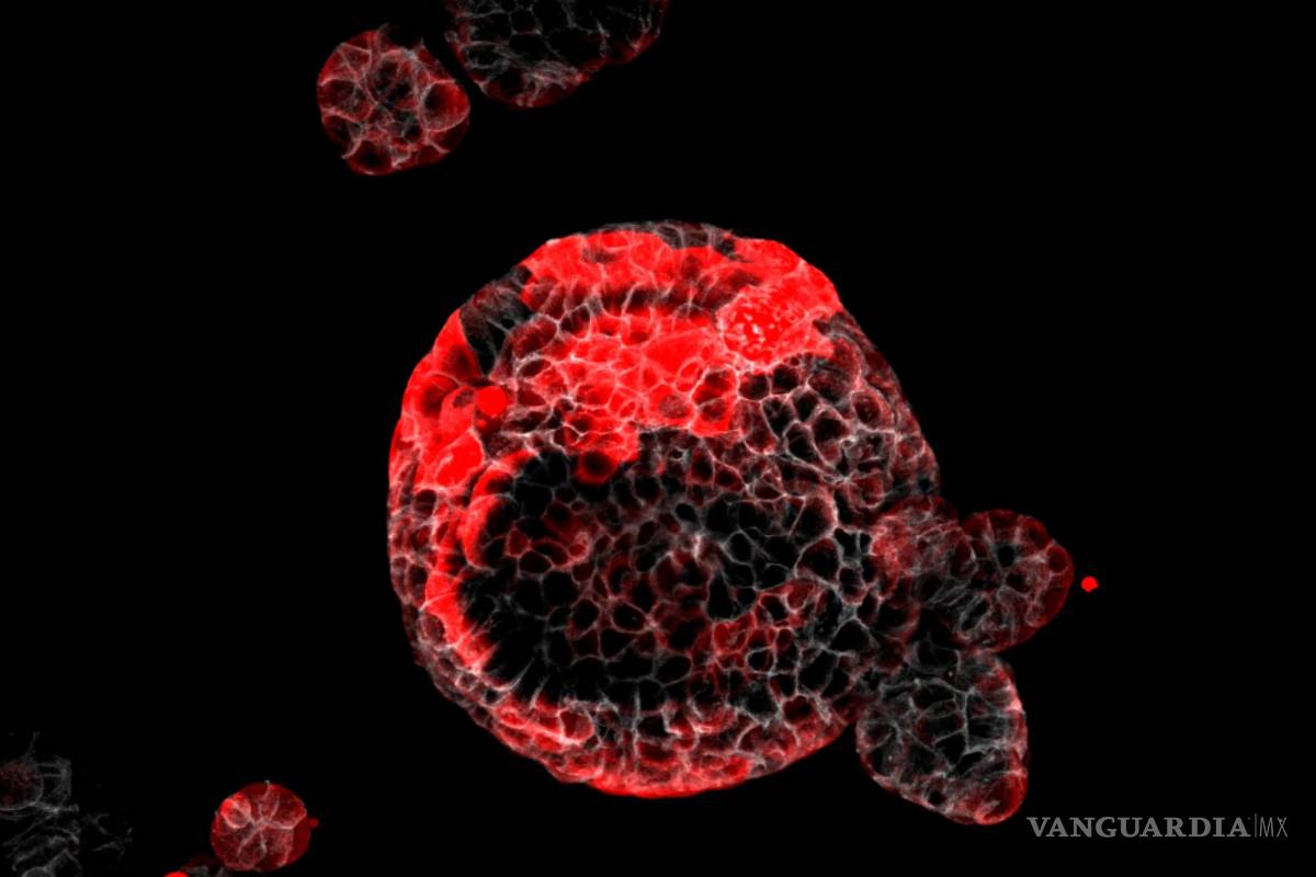 Descubren las células malignas responsables de que vuelva aparecer el cáncer y originan las muertes por metástasis