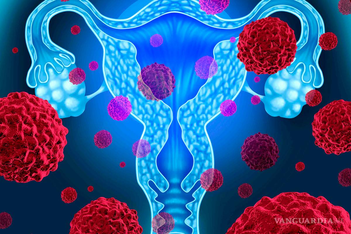 Desarrollan estrategia molecular para controlar cáncer cervicouterino