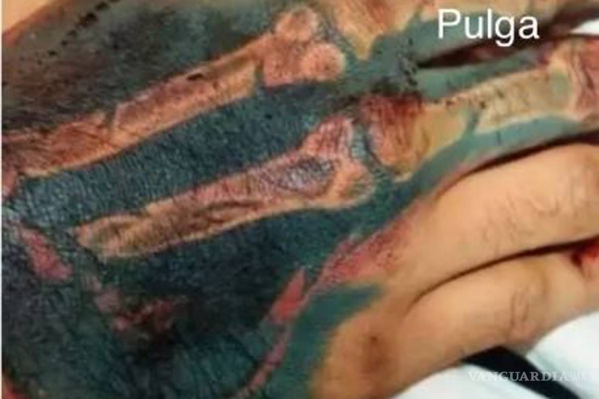$!Sobrino de 'La Pulga', sicario de la Unión Tepito engaña a la policía y escapa de hospital en CdMx