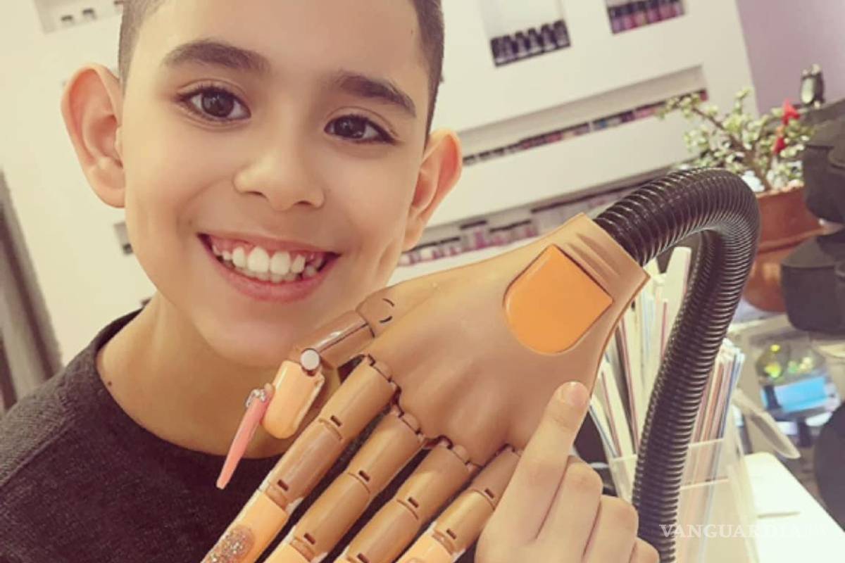 $!Viral: Niño aplica uñas de acrílico para ayudar en operación de su hermanito