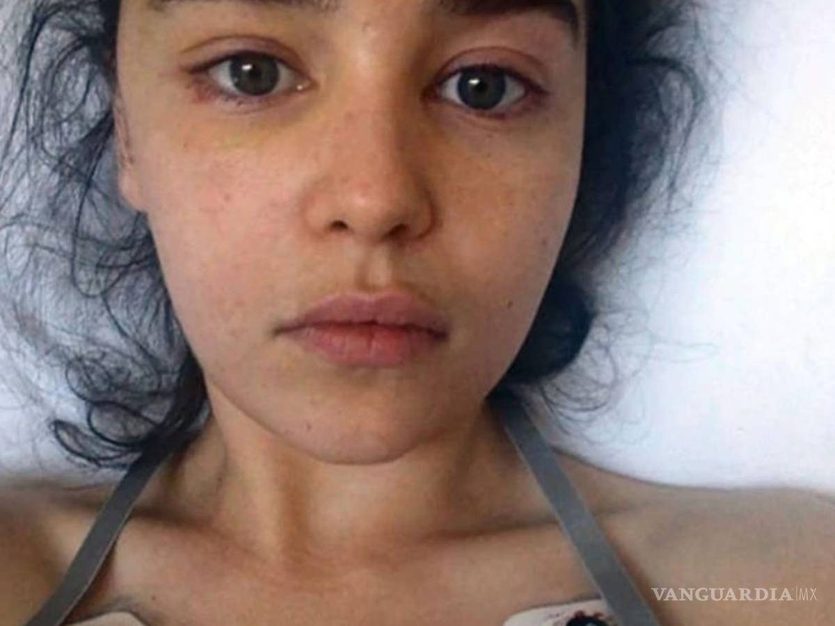 $!Emilia Clarke de Game of Thrones casi pierde la vida y compartió fotos del suceso