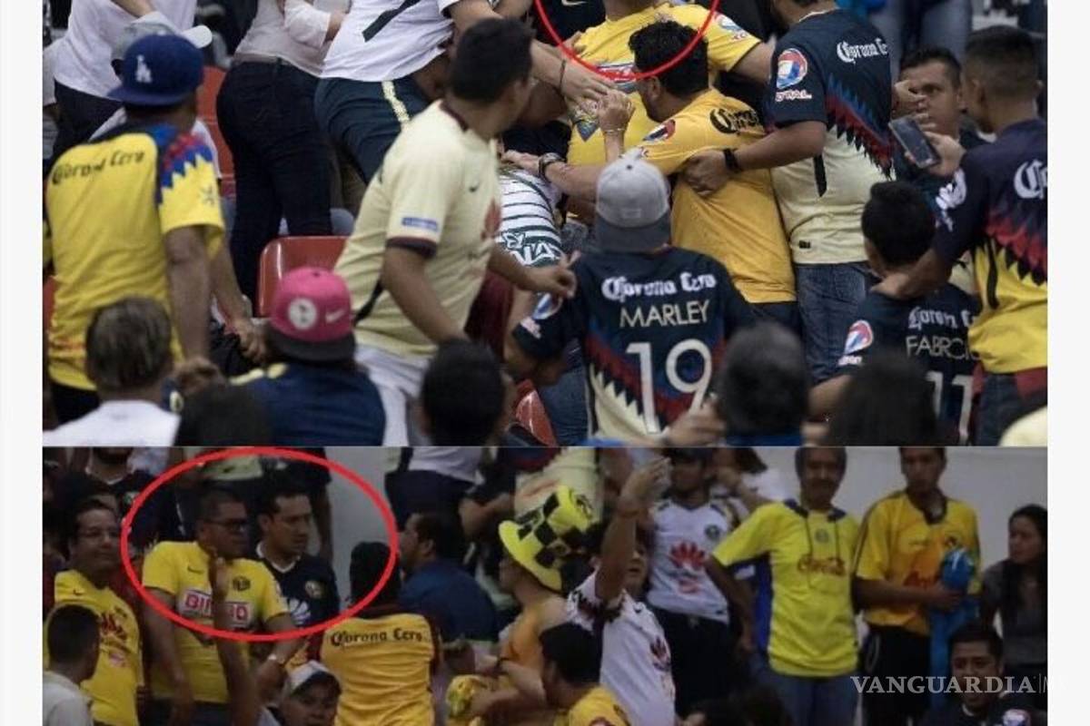 $!Aficionado del Santos requirió de una cirugía reconstructiva en el rostro tras la brutal golpiza que recibió de inadaptados americanistas
