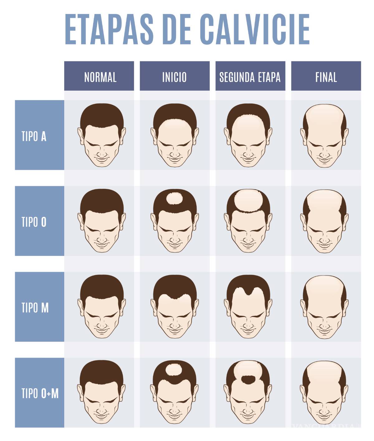 $!Calvicie: el terror en la 'azotea' que nadie quiere experimentar