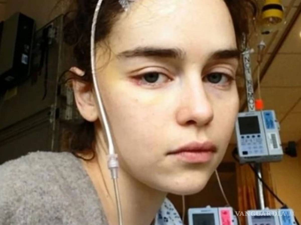 $!Emilia Clarke de Game of Thrones casi pierde la vida y compartió fotos del suceso