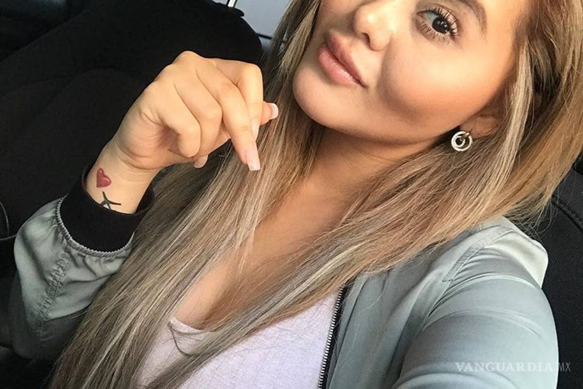 &quot;Gomita&quot; revela su nueva cara, tras su última cirugía