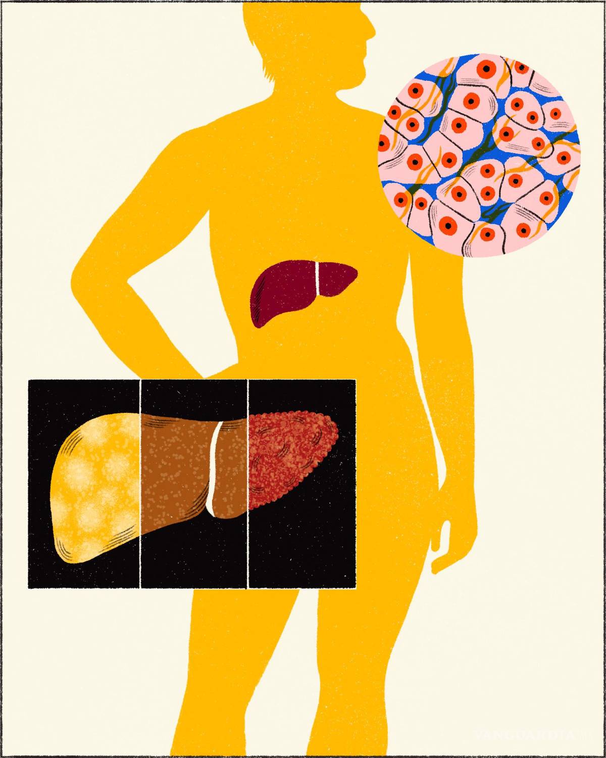 $!Su impacto en el cuerpo va mucho más allá del momento de relajación o euforia que puede provocar.