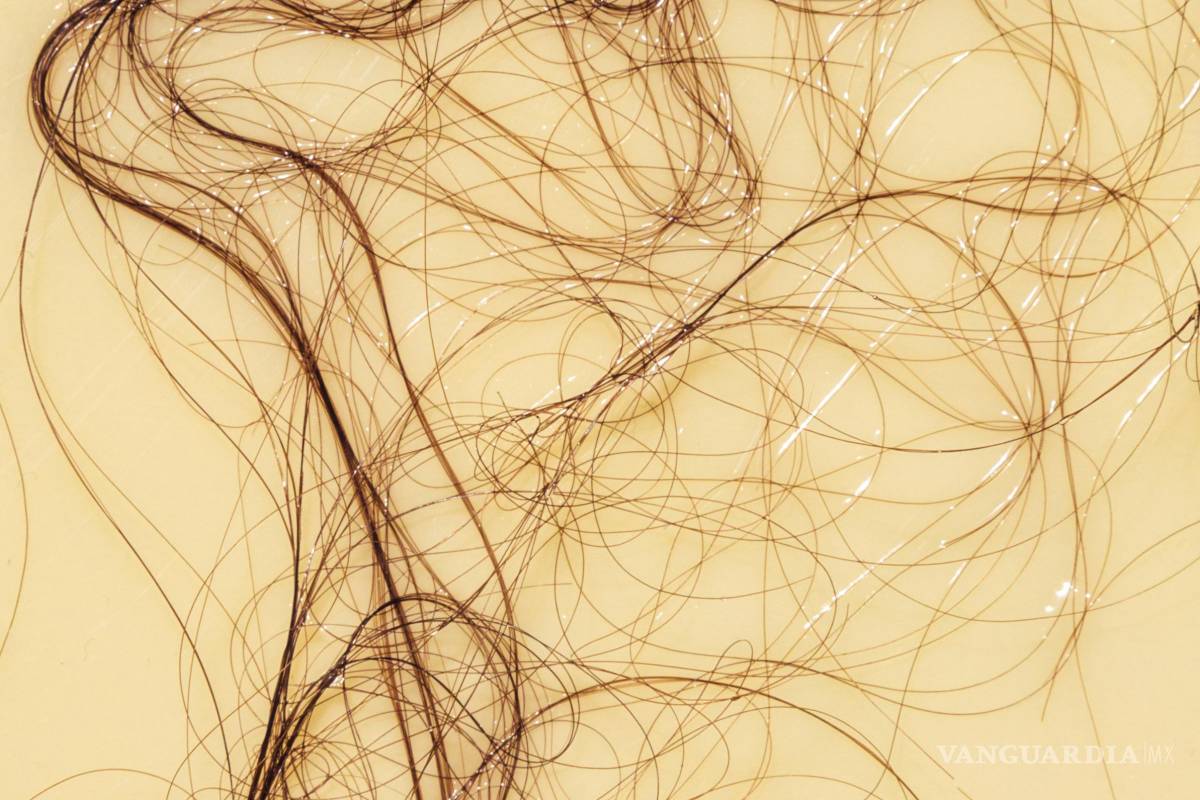 ¿El estrés puede provocar la caída del cabello?