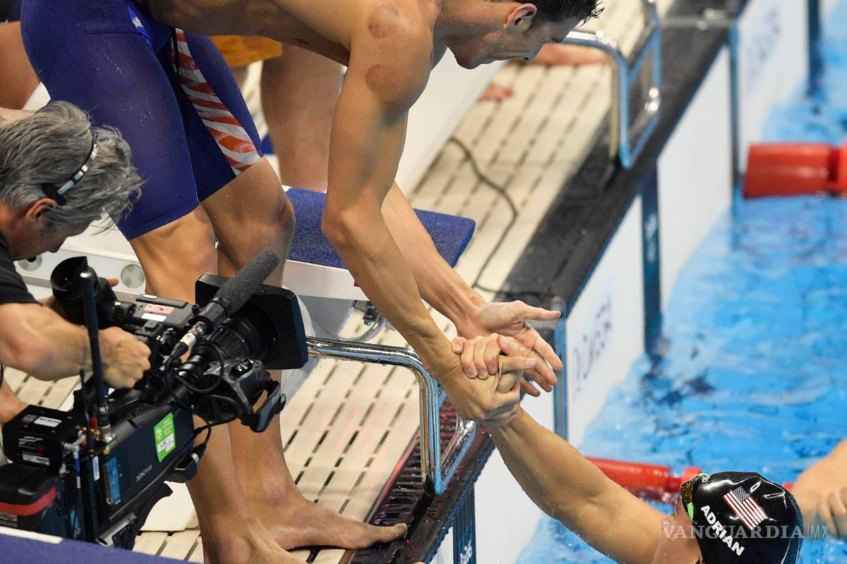 Te explicamos la razón de las extrañas marcas que tiene Michael Phelps en su cuerpo