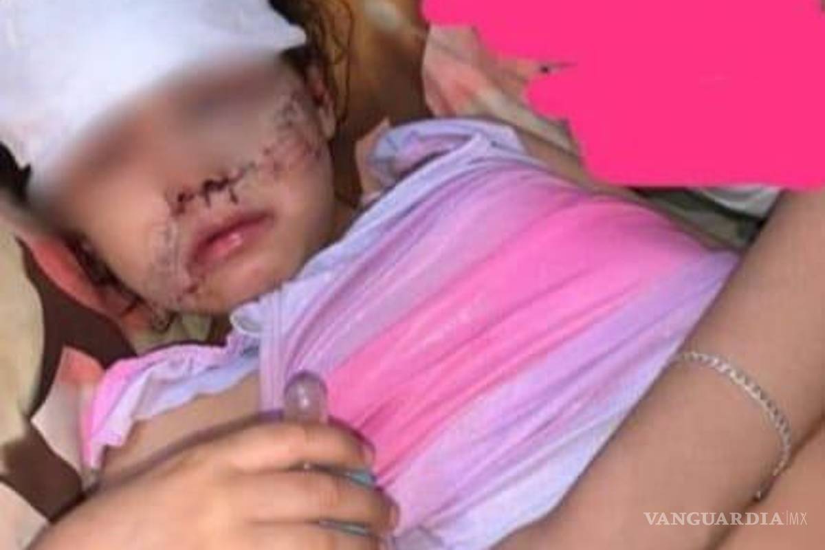 Piden apoyo para niña atacada por un perro en la colonia Nueva Merced, de Torreón