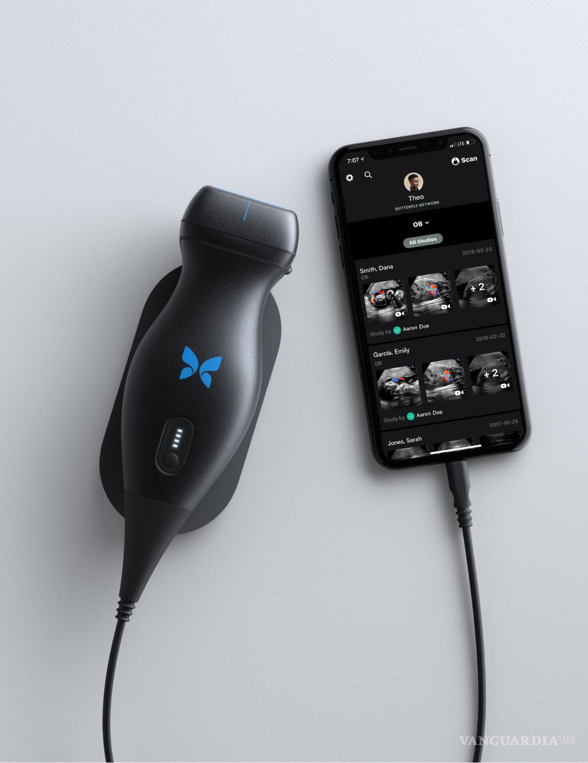 $!Con Butterfly iQ ya puedes ver tus ecografías desde tu celular
