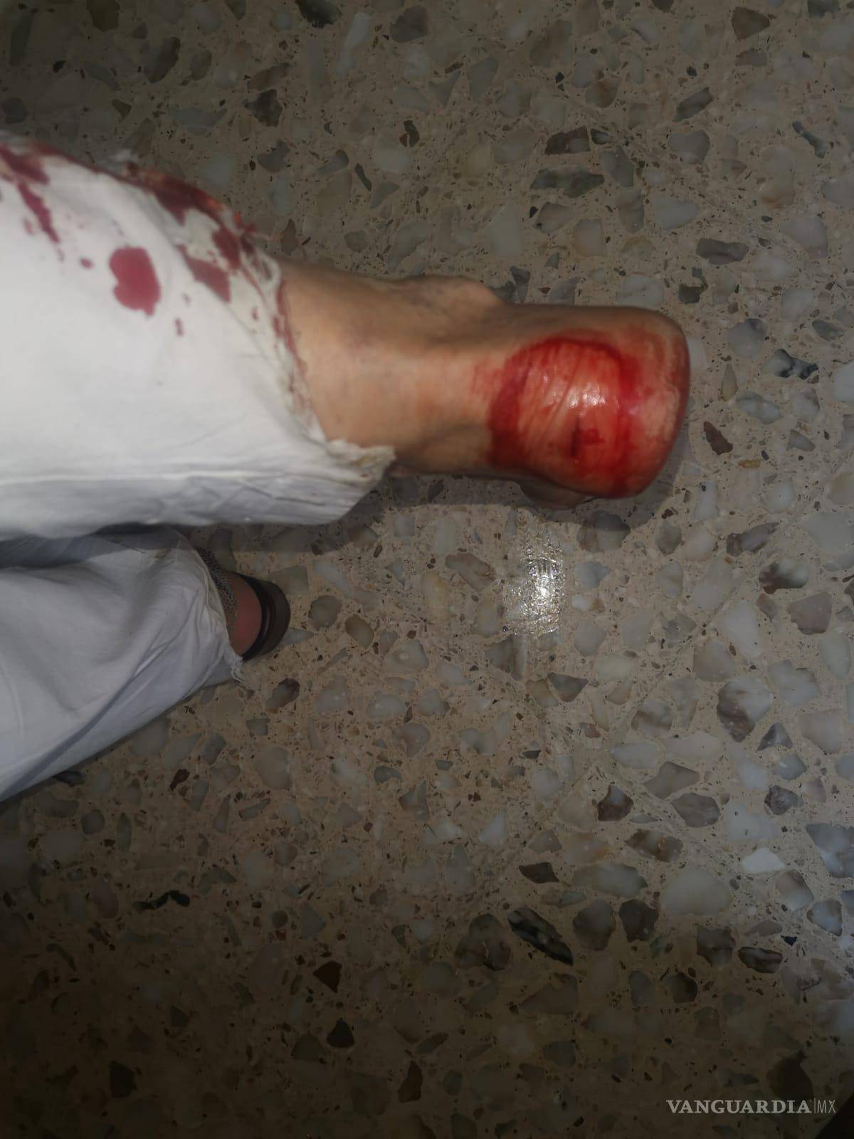 $!Necesitó suturas en algunas de las heridas, que fueron profundas.