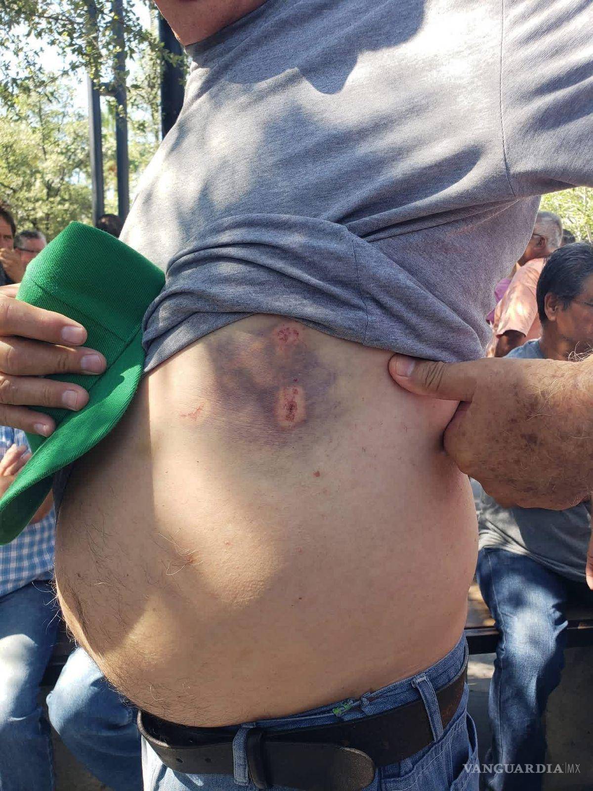 $!Ex trabajadores de AHMSA mostraron lesiones y moretones durante la reunión realizada en la Plaza Principal de Monclova, tras el desalojo del bloqueo en la Carretera 57.
