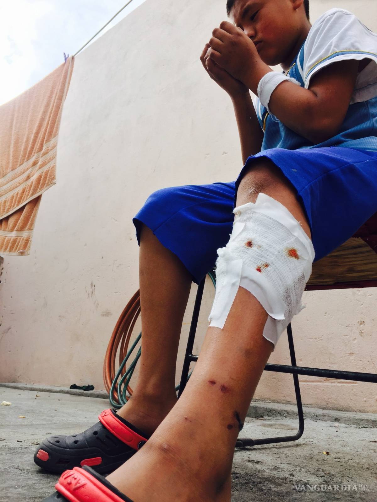 $!Nadie se hizo cargo del pitbull que mordió al niño de 11 años en Saltillo