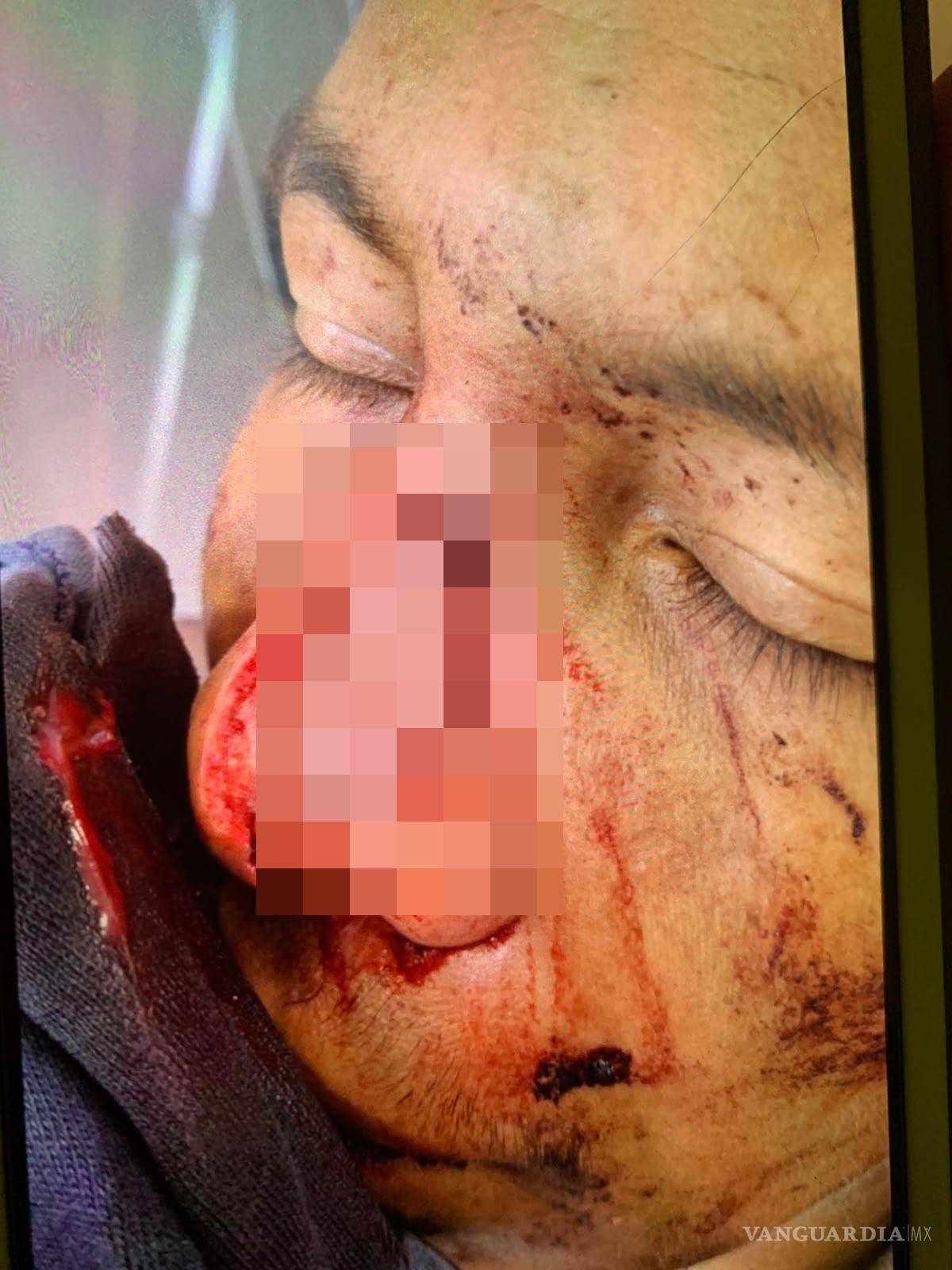 $!Paramédicos de Cruz Roja trasladaron al joven a un centro médico para recibir atención especializada.