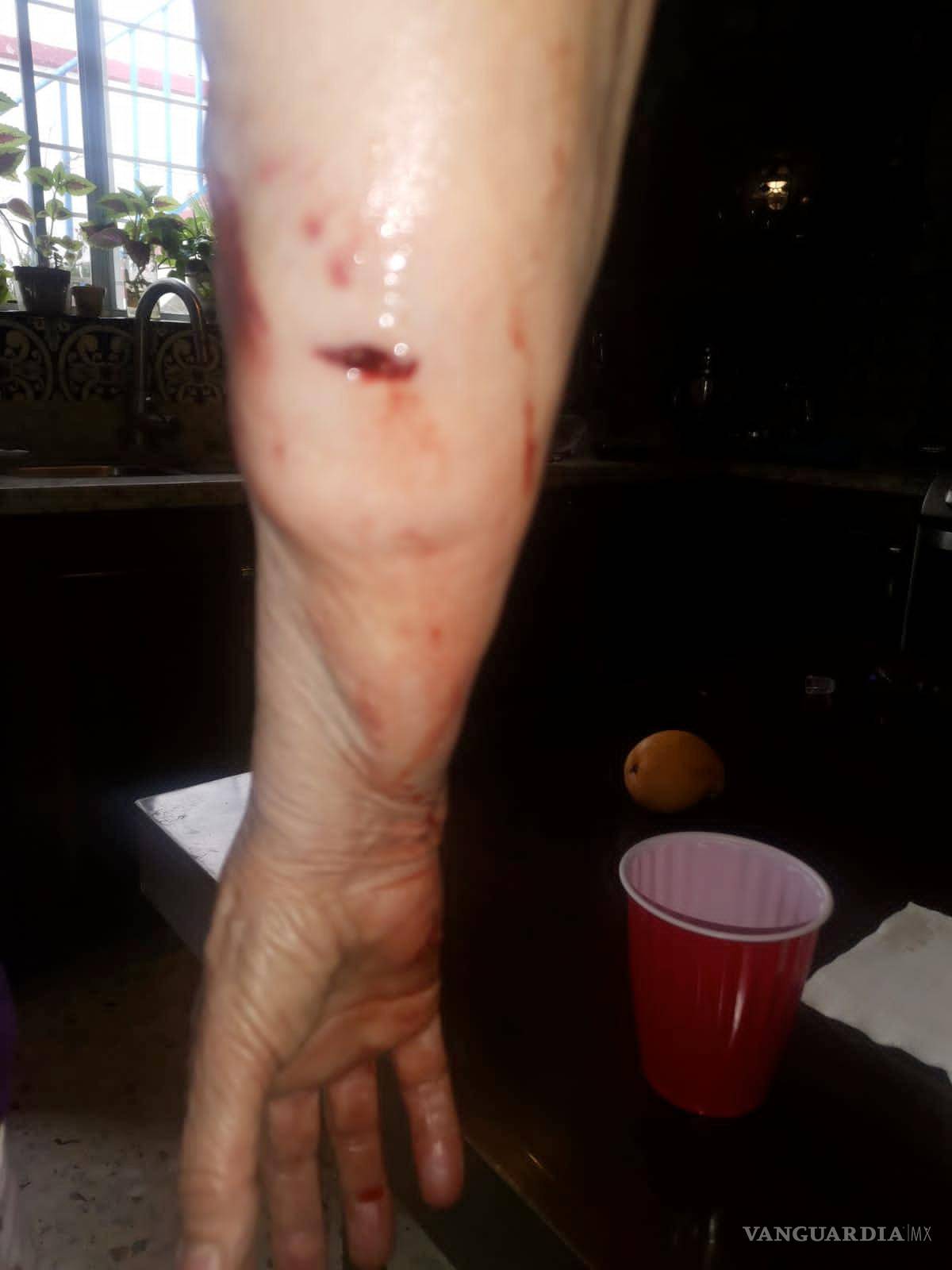 $!La maestra sufrió heridas en varias partes de su cuerpo.