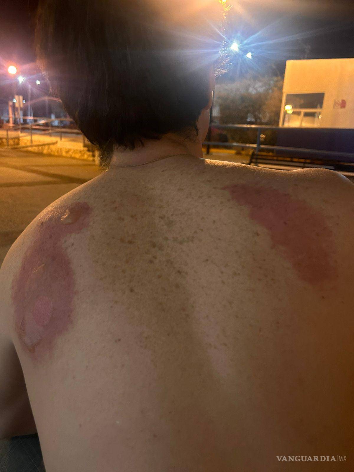 $!Algunos de los asistentes terminaron con quemaduras graves.