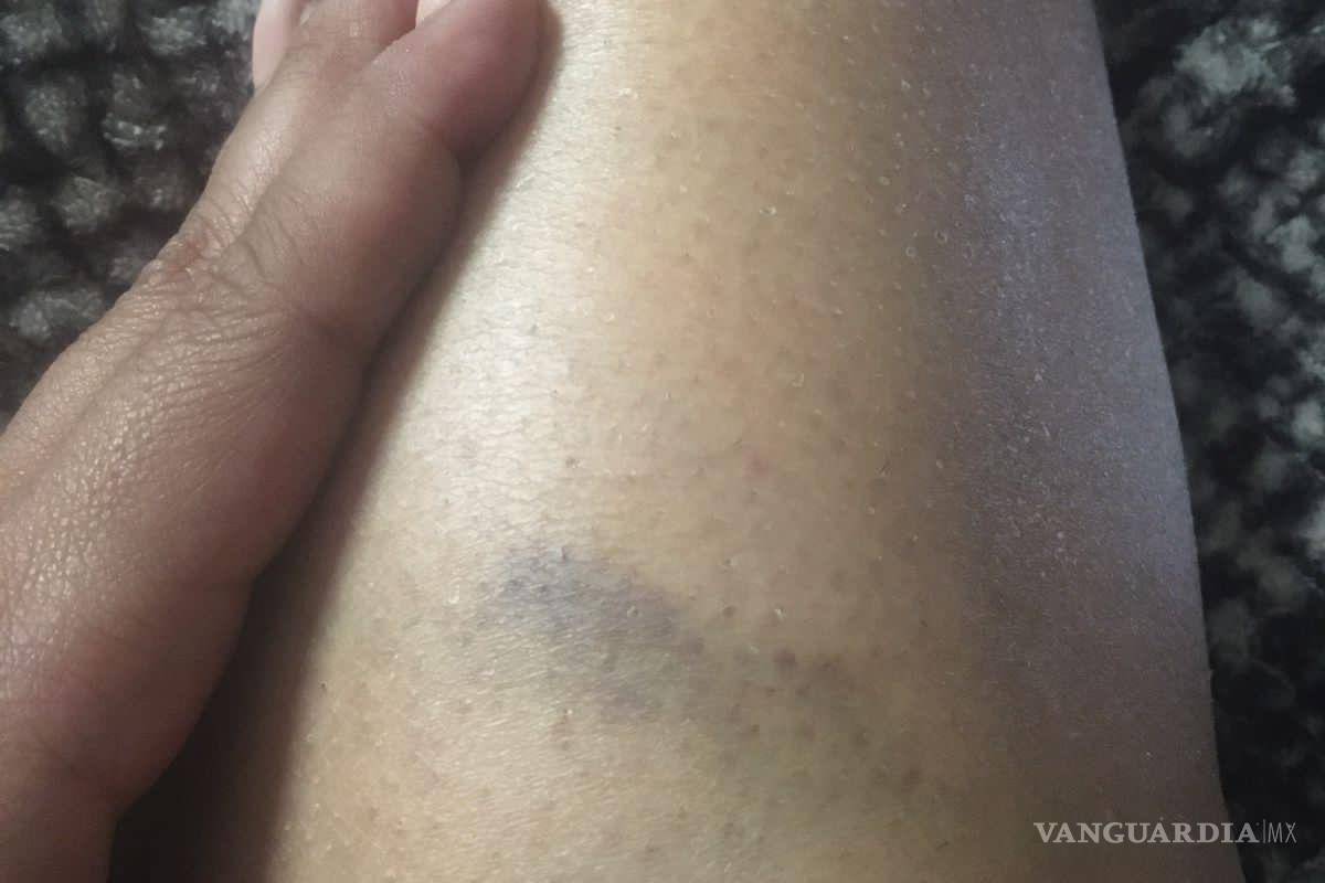 Paramédico de la Cruz Roja de Saltillo viola orden de restricción y agrede a ex pareja