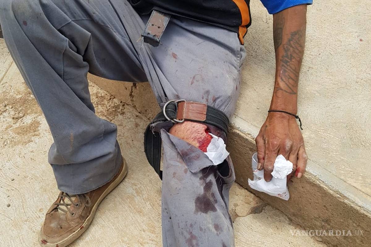 Ataca perro a peatón y le arranca un dedo