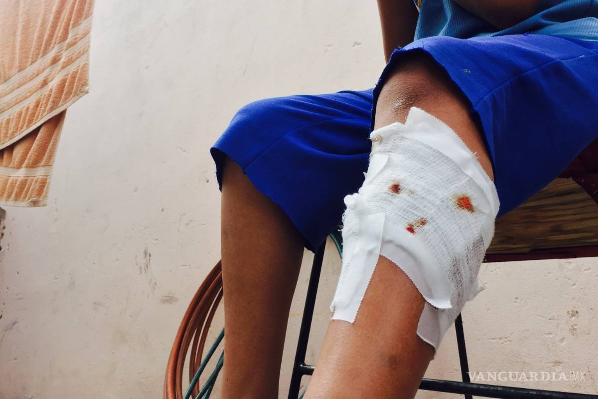 $!Nadie se hizo cargo del pitbull que mordió al niño de 11 años en Saltillo