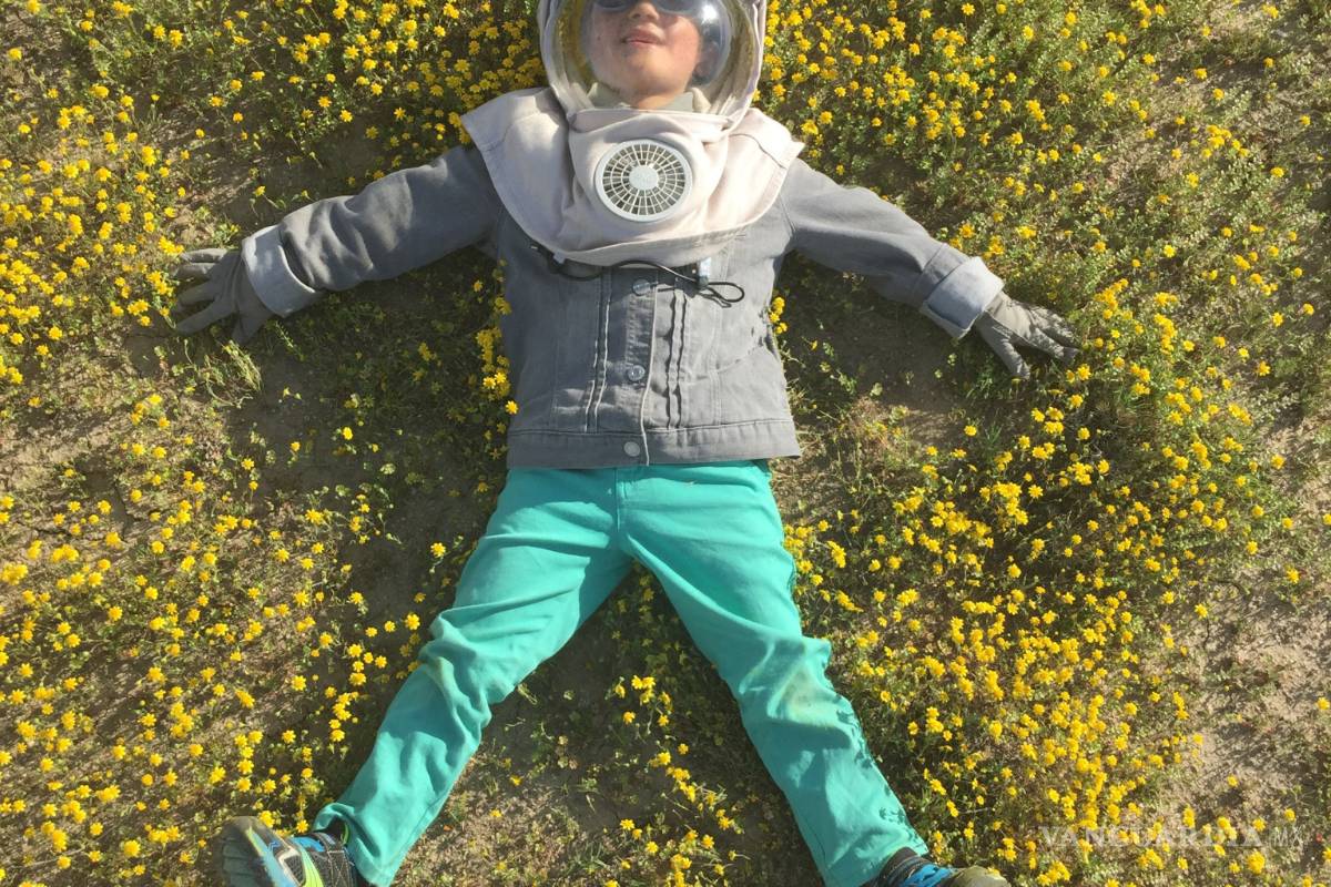 Oliver Kei, el 'hijo de la luna': es tan alérgico al sol que debe usar un traje especial todos los días