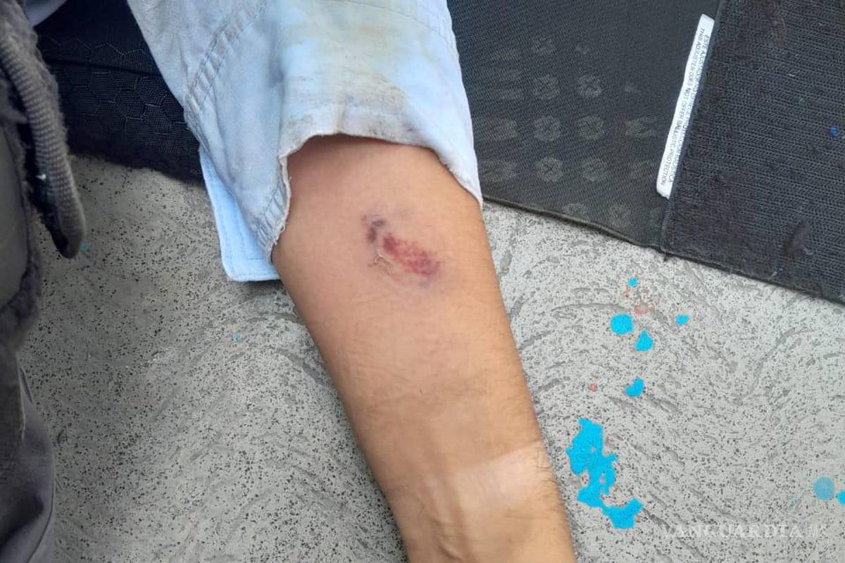 Hombre agrede a mordidas a policías de Monterrey que lo detienen en un jardín de niños