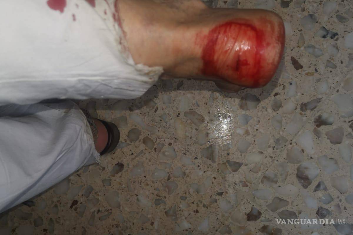 $!Necesitó suturas en algunas de las heridas, que fueron profundas.