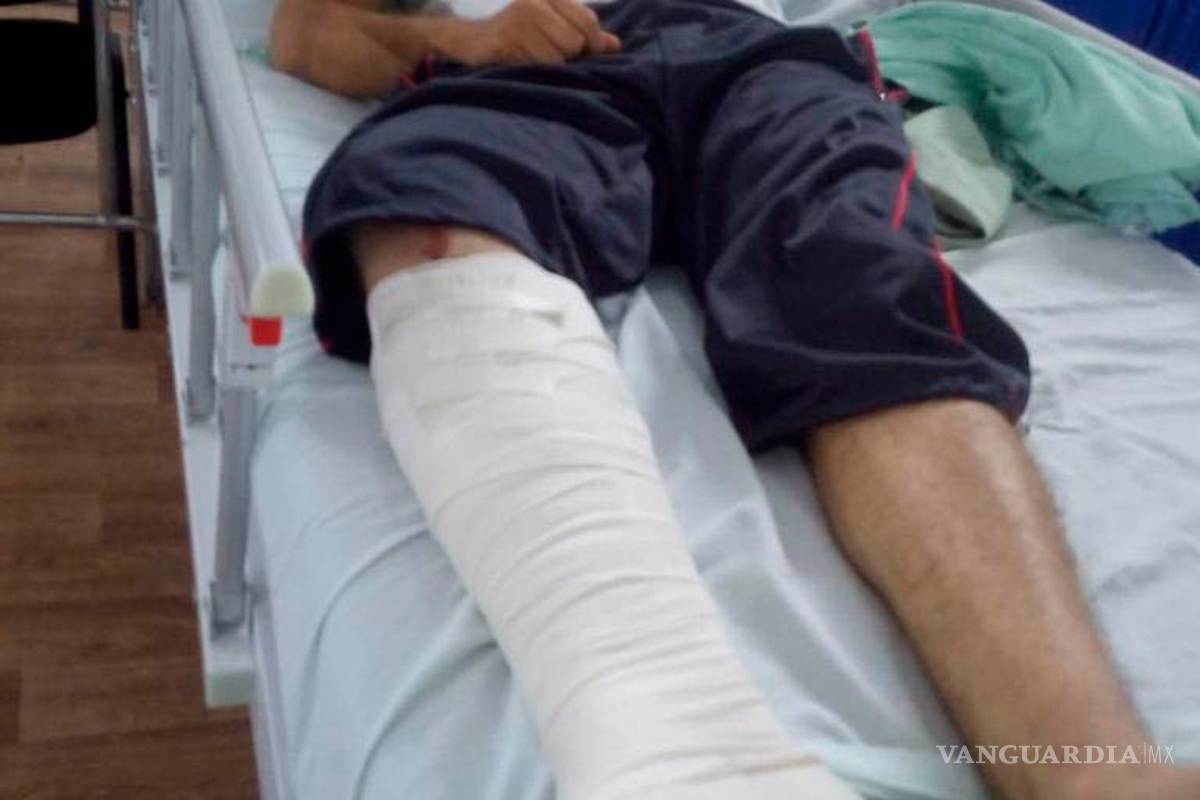 Atropellan en Monclova a candidato a diputado del PRD y huyen