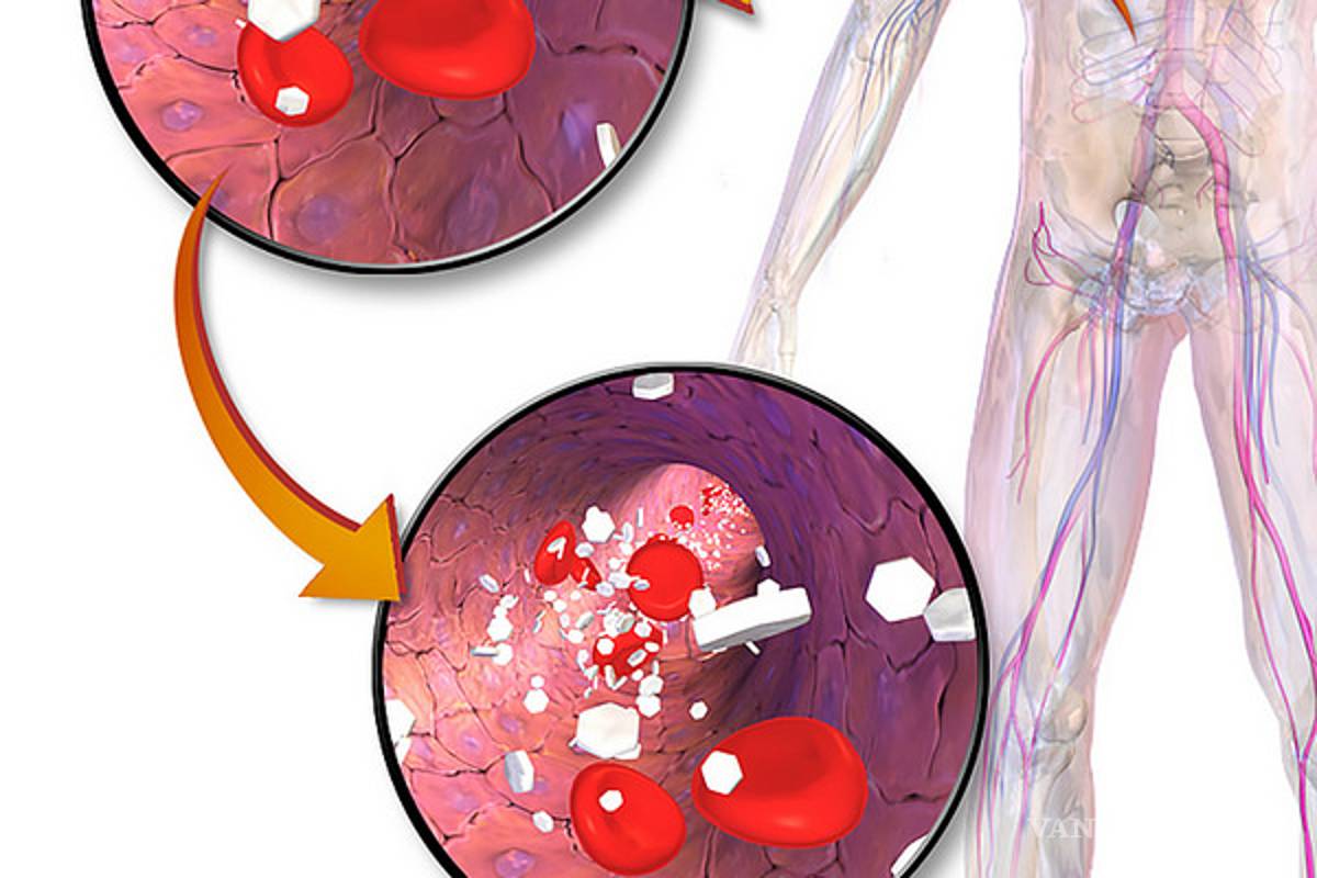 $!Cuál es el riesgo de suministrar tipo y dosis incorrectas de insulina en el paciente diabético