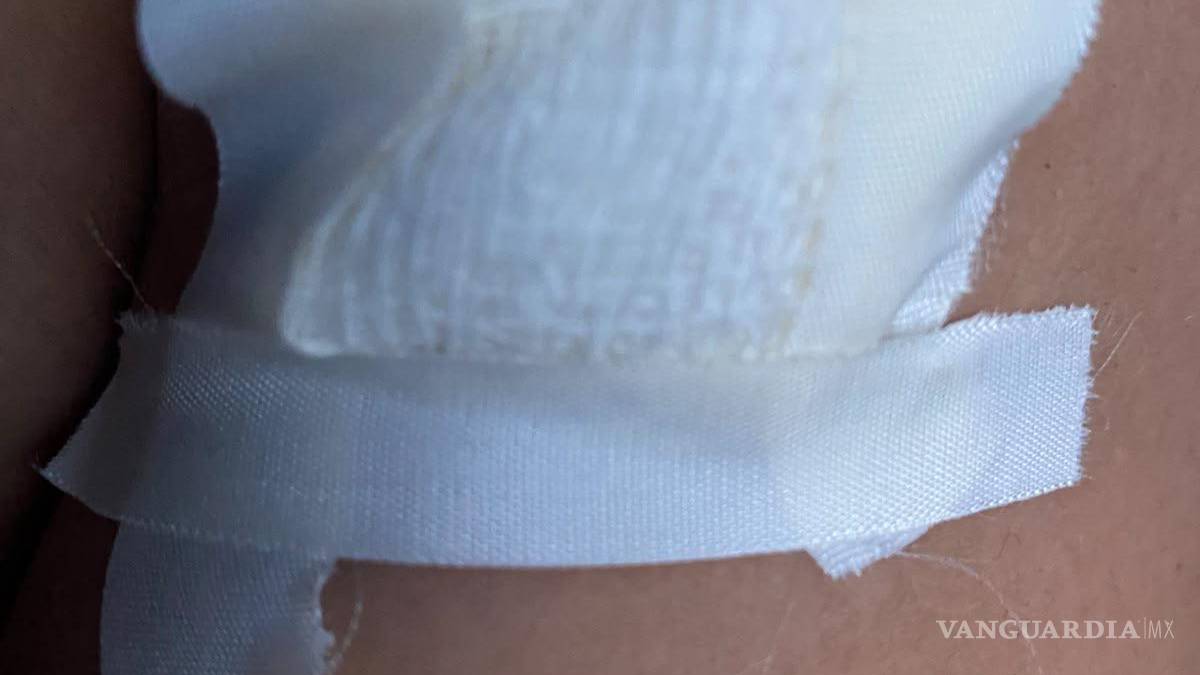 Golpean y lesionan a familia por conflicto de propiedad, en Saltillo