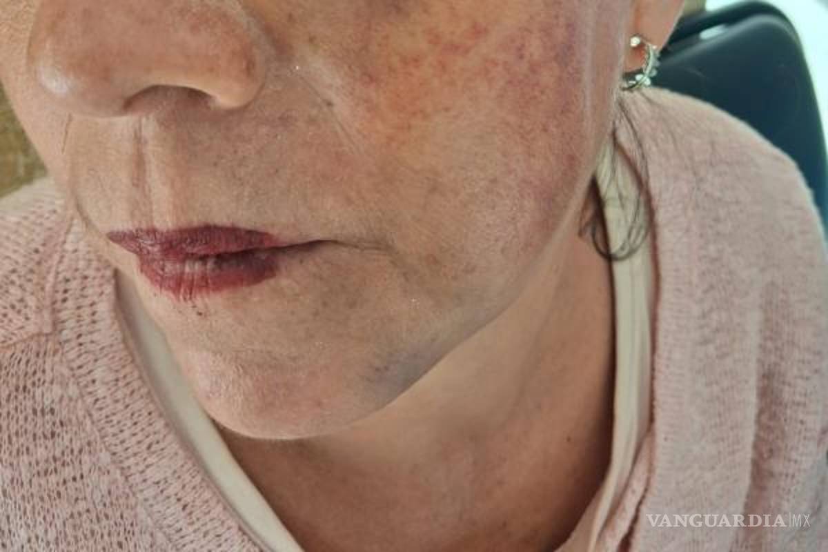 $!La afectada tenía seis meses internada cuando ocurrieron los hechos.