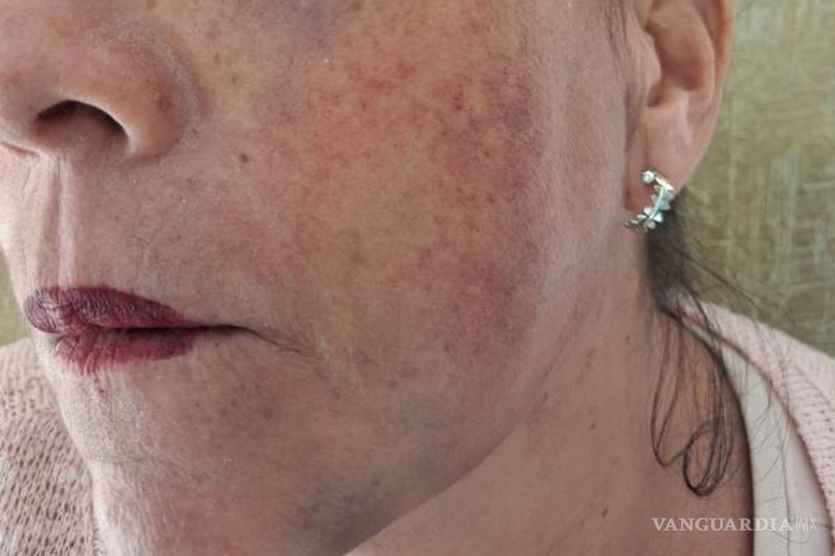 $!La víctima recibe atención médica por lesiones internas y daño auditivo.