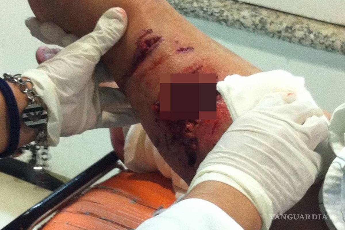 Ataca pitbull a mujer y le arranca parte de la pierna; vecinos matan al perro, en Saltillo