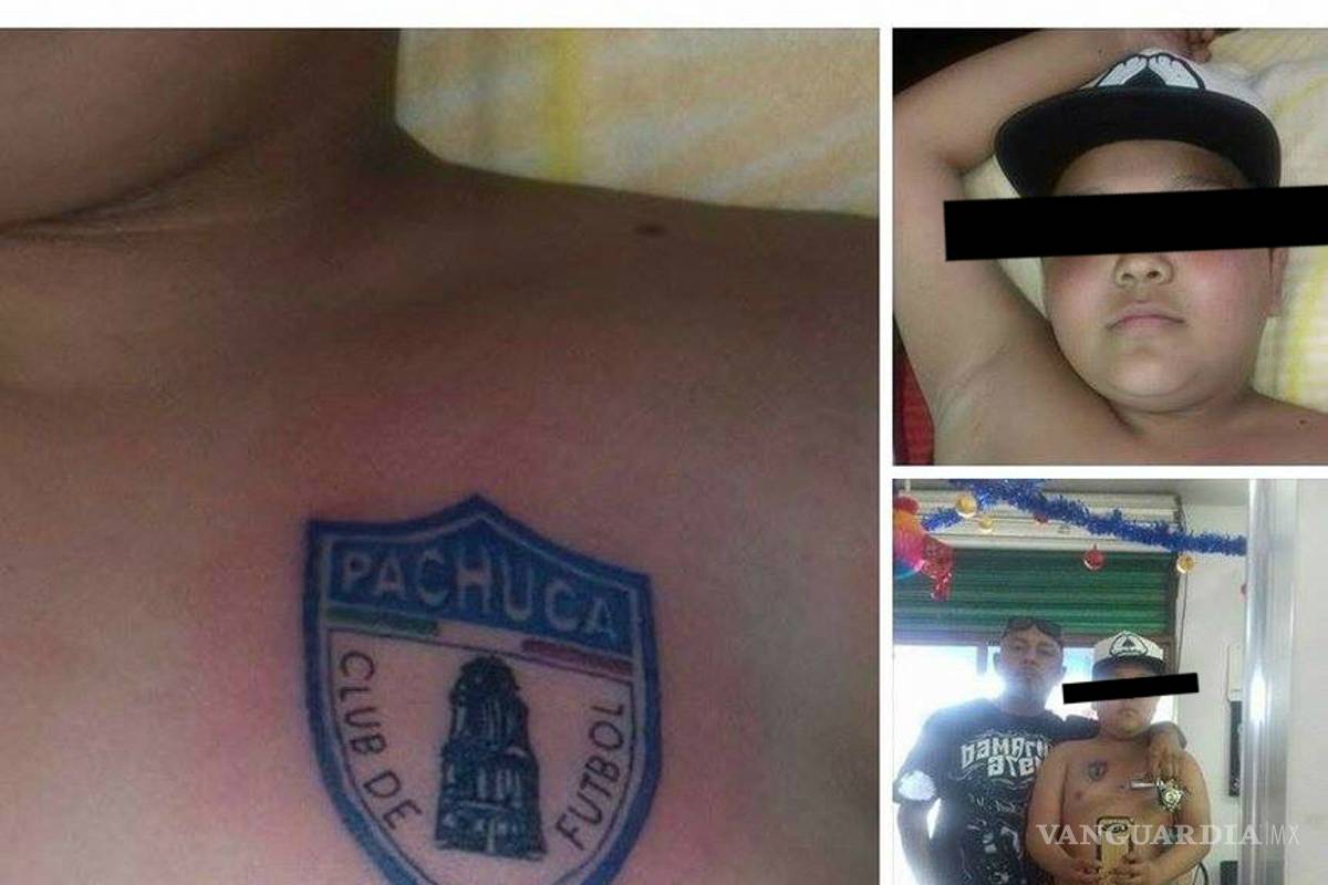 Papá tatuó el escudo del Pachuca a su hijo... de tan sólo 12 años