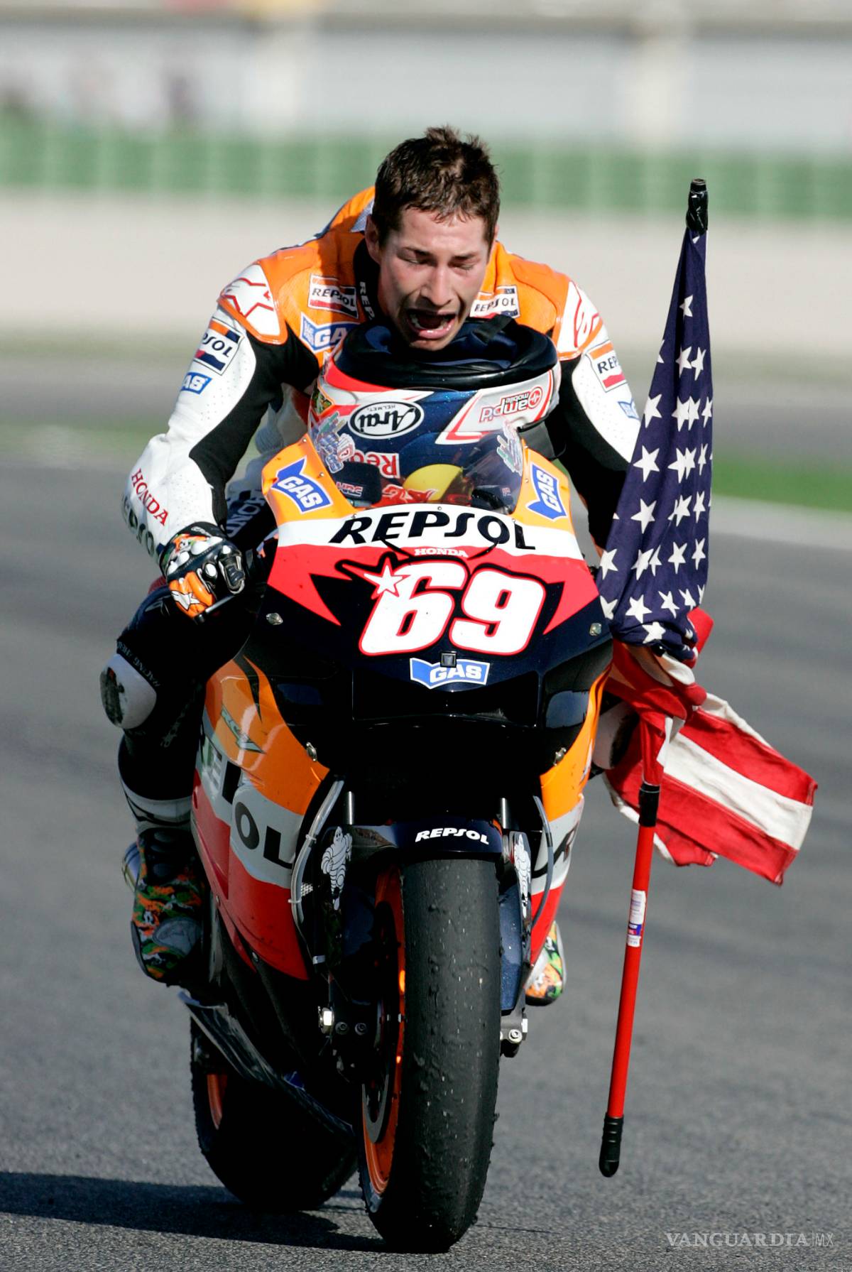$!Nicky Hayden, después de ser atropellado cuando iba en bicicleta en Italia