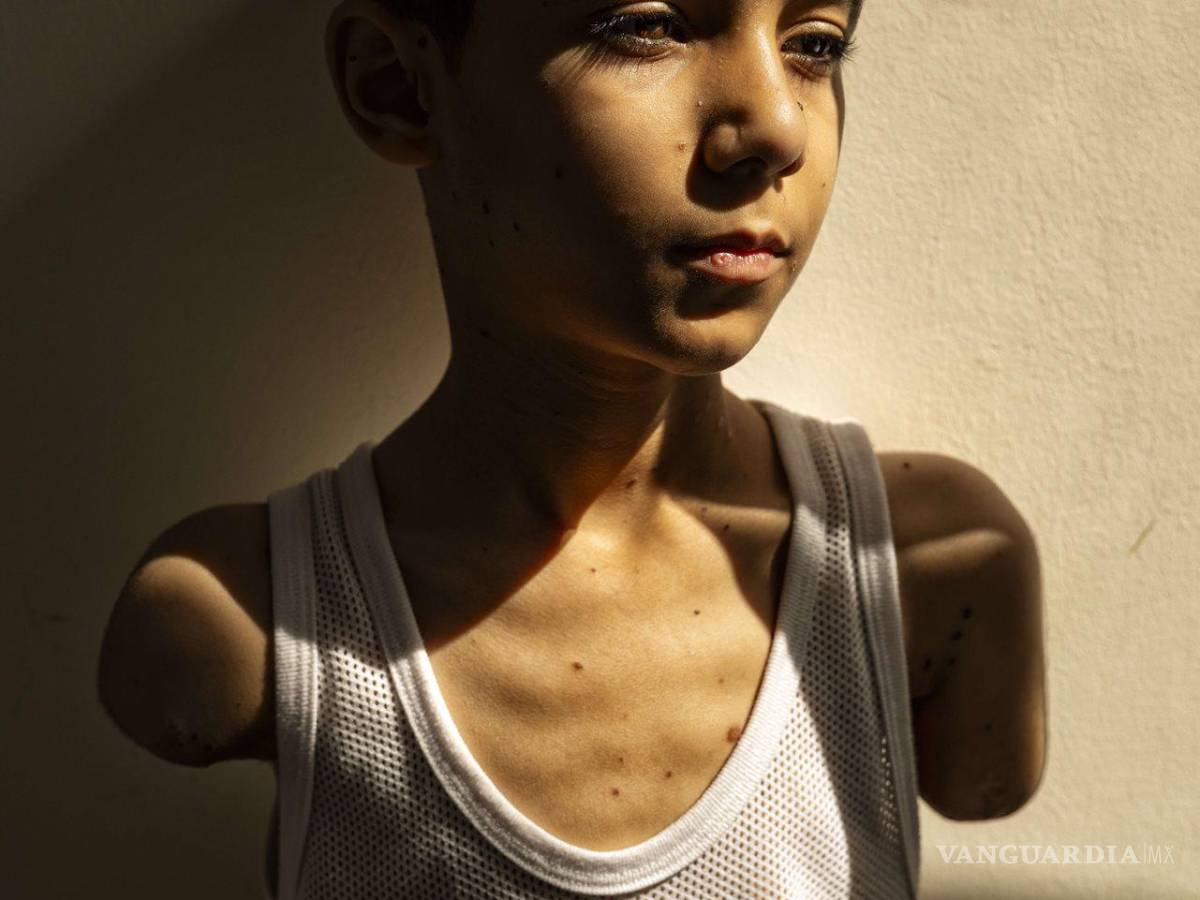 $!En la imagen Mahmoud Ajjour, de la fotógrafa palestina Samar Abu Elouf para The New York Times.