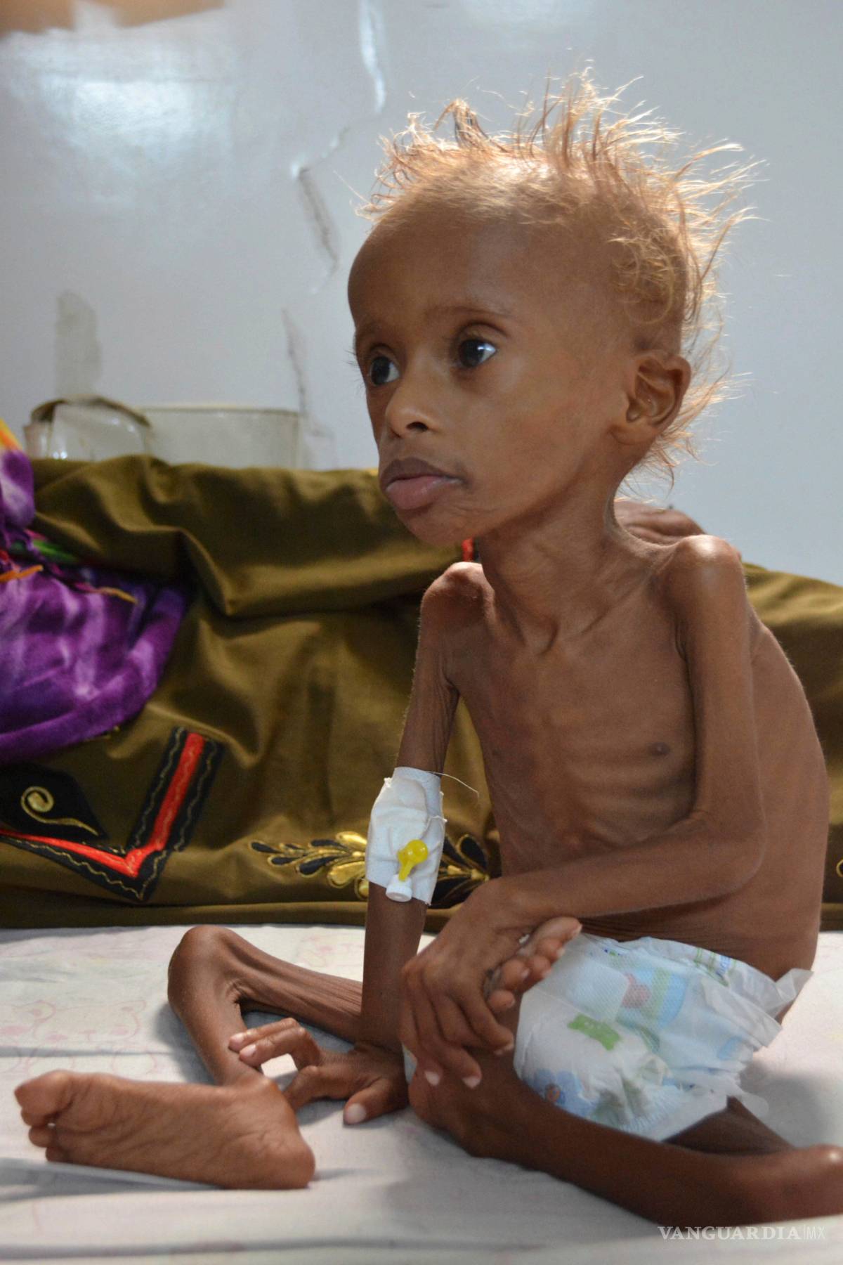 $!130 niños o más mueren cada día en Yemen: Save the Children