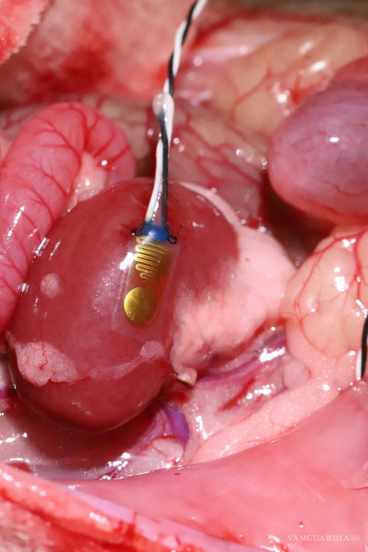 $!Dispositivo implantado en un riñón de roedor (cobayo).