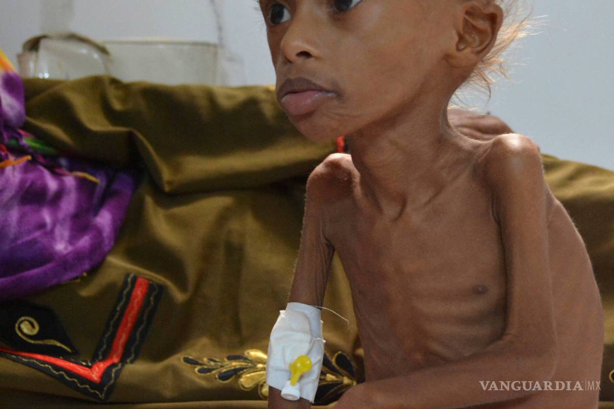$!130 niños o más mueren cada día en Yemen: Save the Children
