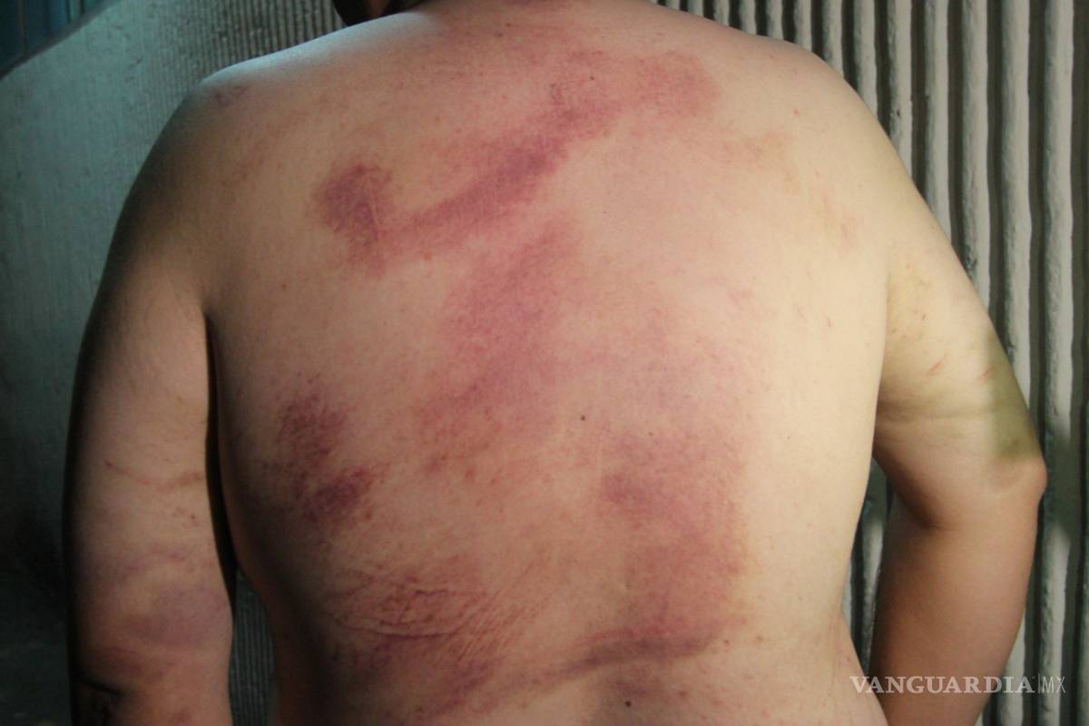 $!Vinculan a proceso a policías por tortura y abuso de autoridad en Saltillo