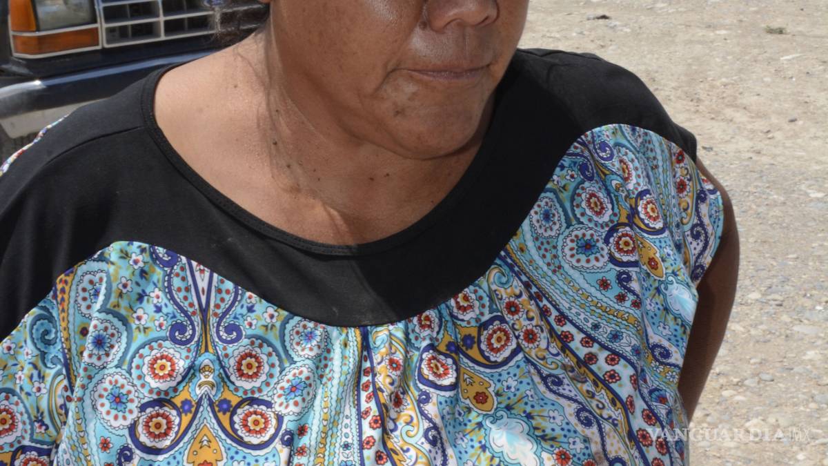 Dan de alta a mujer mordida por 2 pitbull... aunque no puede caminar